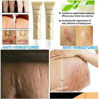 GUOCUI BIO TECH Crème Grossiste Répare Cicatrices Anti-inflammatoire et Cicatrices d'Acné, Traitement de l'Acné et des Vergetures