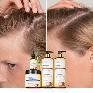 Servicio OEM, Aceite Botánico para Fortalecer el Cuero Cabelludo, Aceite Ligero para el Cuidado del Cabello con Romero, Cebolla y Biotina para el Crecimiento del Cabello, Uso Profesional - Product Image 2