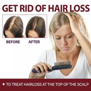 Huile de croissance capillaire à étiquette privée Traitement de croissance capillaire Sérum Huile capillaire à la biotine profonde pour traiter la perte de cheveux à la racine du cuir chevelu - Product Image 3