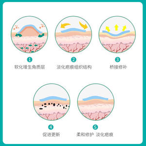 Nanjing Tongrentang Patchs médicaux en silicone pour cicatrices, 3 pièces par paquet, pour brûlures, ébouillantements, traumatismes, atténuation des cicatrices postopératoires - Product Image 4