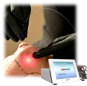 <span class=keywords><strong>Precio</strong></span> de fábrica Endolaser Facelift Máquina de estiramiento de la piel 980nm 1470nm Dual Laser Tratar la flacidez de la piel de la cara Sin corte - Product Image 4