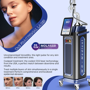 Máquina de Láser Fraccional de CO2 de 10600nm de Alta Potencia para Tratamiento de la Piel y Eliminación de Papilomas, Uso Comercial, Exportación a EE. UU. - Product Image 6