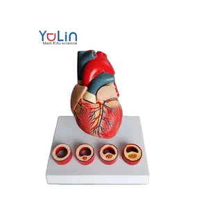 Модель сердечной патологии, модель сердечного заболевания, модель коронарного атросклеротического сердечного заболевания