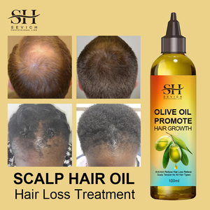 El <span class=keywords><strong>Mejor</strong></span> Tratamiento Anticaída <span class=keywords><strong>del</strong></span> Cabello, Aceite de Oliva Herbal, Suero de Crecimiento Capilar de Acción Rápida <span class=keywords><strong>para</strong></span> Mujeres Negras - Product Image 3