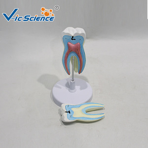 Modèle de molaires modulaire en trois parties, représentant la structure d'un dentier cariote, utilisé comme outil pédagogique et de formation en milieu scolaire - Product Image 4