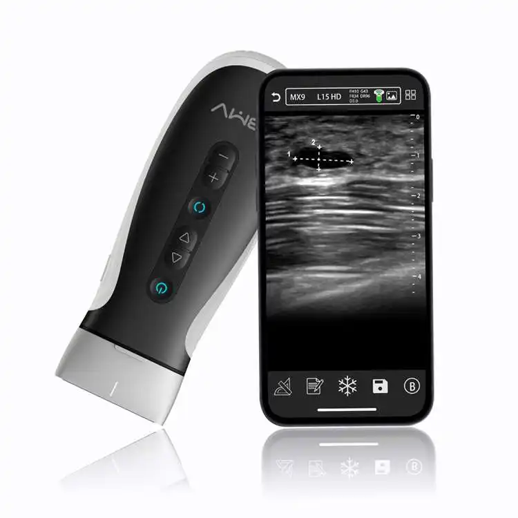 Connessione Wireless Medico Intelligente Intelligente Ad Ultrasuoni Sonda B/W Colore Doppler App POC Portatile Ad Ultrasuoni Convessa Sonda Lineare