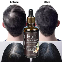 Huile Essentielle Capillaire Fectory Rose, Escargot et Gingembre pour Enfants, Huile de Croissance Capillaire Olive pour Femmes Noires, Effet en 7 Jours, Personnalisation Chine