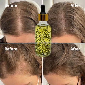 Rozemarijn Etherische Olie Haarverzorging Verdunning Hoofdhuid Behandeling Natuurlijke Kruiden Anti Haaruitval Haar Plant <span class=keywords><strong>Extract</strong></span> Etherische Olie - Product Image 1