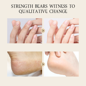 OEM 개인 라벨 안티 크랙 핸드 풋 크림 30g 수리 드라이 크랙 힐 보습 영양 진정 소프트 스킨 케어 크림 - Product Image 5