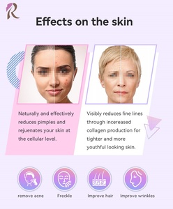 Appareil <span class=keywords><strong>de</strong></span> soin du visage à haute fréquence, baguette 20W, puissance élevée, éliminateur <span class=keywords><strong>de</strong></span> points noirs, pour salons <span class=keywords><strong>de</strong></span> beauté et usage domestique - Product Image 2