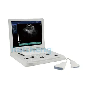 Cheap Laptop 2D Color Doppler Portable Color Doppler With Convex Linear Probe Ultrasound Machine