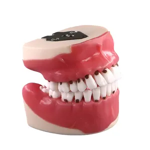 Jingle Hot Sales Adulto Dentes Dentais dentes tipodont periodontais Modelo para a educação