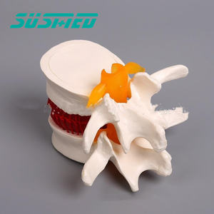 Modèle de démonstration de hernie discale lombaire humaine modèle d'enseignement de l'anatomie de la pathologie discale - Product Image 4