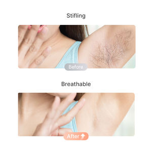 Depiladora Eléctrica TOUCHBEAUTY <span class=keywords><strong>para</strong></span> Mujer, Resistente al Agua, <span class=keywords><strong>para</strong></span> Uso Doméstico, Recortadora, Depiladora, Funciona con Batería, Pinza - Product Image 4