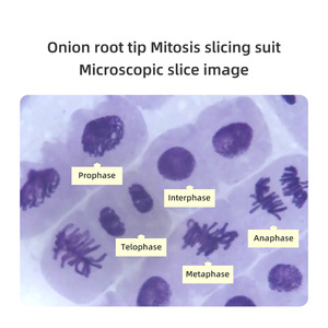 A set of 5 onion root tip cell mitotic sections (2n=16) showing cell proliferation in the root tip meristem. - Product Image 4
