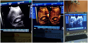 Sunbright เครื่อง SUN-800D หน้าจอ15 ''แบบพกพาเครื่องมือสัตวแพทย์เครื่องอัลตราซาวด์สำหรับสัตว์ - Product Image 3