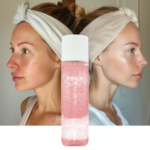 OEM y ODM al por mayor cara hidratante refrescar revitalizar Anti acné té verde tóner fresco 160ml tóner ordinario <span class=keywords><strong>ácido</strong></span> <span class=keywords><strong>glicólico</strong></span> - Product Image 1