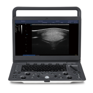 Sonoscape E2 Pro Vet dengan Satu Transduser Mesin Pemindai USG <span class=keywords><strong>Doppler</strong></span> Warna Portabel untuk Hewan, Mesin Pencitraan Digital - Product Image 2
