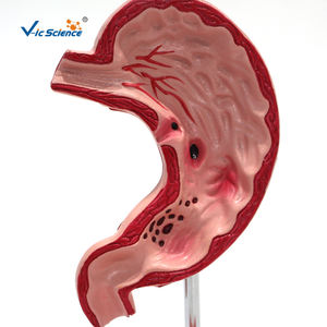 Model perforasi lambung dan perforasi lambung - Product Image 2