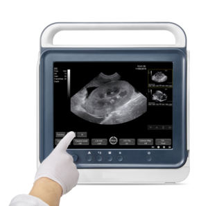 AMAIN Tragbarer Tierarzt Ultraschall Touchscreen Veterinär Drahtloser Farb doppler Ultraschalls canner für Tierarzt Hunde Schaf Kuh - Product Image 4