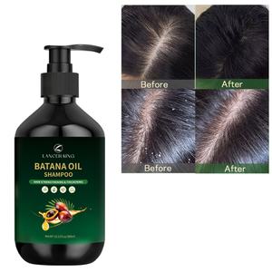 Champú de Aceite de Batana LANCER KING 300ml, Natural y Orgánico, Fortalecedor del Cabello, con Aceite de Árbol de Té, Hidratante, Marca Privada - Product Image 1
