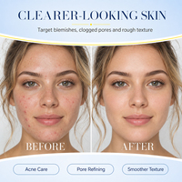 Gel Réparateur Anti-Imperfections et Anti-Points Noirs à Marque Blanche – Soin Visage Éclaircissant, Lissant et Resserre les Pores, Élimine l'Acné