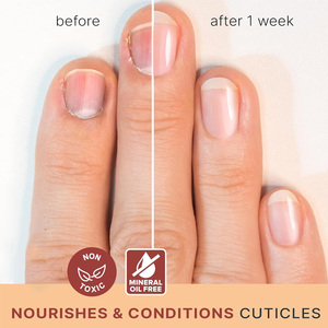 Aceite para el Cuidado de las Uñas con Propóleo y Aceites Esenciales. Fortalece e hidrata las uñas secas, débiles y frágiles. Fortalecedor de Uñas de Acción Rápida - Product Image 4