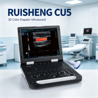 Échographe Doppler Couleur Portable 3D RUISHENG CU5 – Appareil Médical pour Hôpital (Abdomen, Cardiaque, Obstétrique/Gynécologie, Vasculaire)