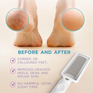 Scrubber per lima raschiante per rimozione calli professionale per pelle morta e tacchi screpolati efficaci su piedi asciutti - Product Image 5