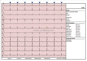 Electrocardiógrafo Veterinario, Monitor de Salud Médico, Interpretación de EKG, Taquicardia Ventricular, ECG para Perros - Product Image 5