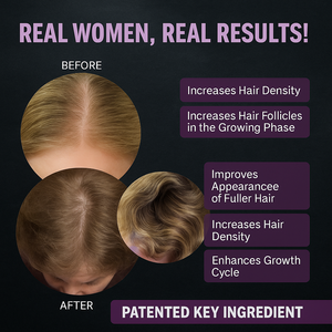 OEM/ODM, Самые продаваемые медвежьи веганские биотиновые коллагеновые мармелад для красоты, ногти для волос, мармелад для роста волос - Product Image 5