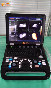 SUN-906A Dispositivo de Diagnóstico por Ultrasonido Doppler a Color Totalmente Digital, Máquina de Ecografía Cardiovascular - Product Image 3