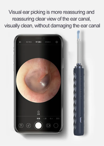 Xách tay HD 3MP Wifi otoscope với 6 LED thép không gỉ ear nội soi ABS chất liệu - Product Image 6