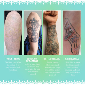 Nouvel arrivage Crème réparatrice de <span class=keywords><strong>tatouage</strong></span> Fixation de la couleur Préservation de la couleur Hydratant et réparateur Verrouillage de la couleur de la peau et anti-propagation - Product Image 2