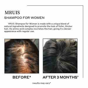 Shampoo densifiant exclusif pour femmes, épaissit les mèches de cheveux, rafraîchit, donne du volume, dit adieu aux frisottis et à l'amincissement, 500 ml, Sylax - Product Image 5