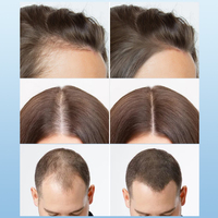 Serum Penumbuh Rambut AHK-CU GHK-CU Private Label, Roller Anti Rontok Cepat, Peptida Tembaga, Perawatan Kulit Kepala, Serum Penumbuh Kembali Rambut