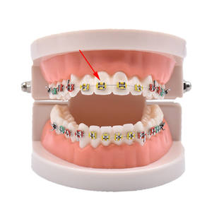 36 couleurs de supports orthodontiques dentaires, sangles de ligature, attaches, bande élastique pour les dents - Product Image 6
