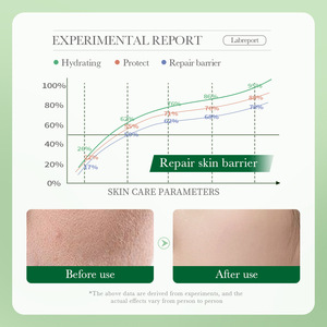 Centella Asiática Skin Care Hidratante Oil-controll Rosto Serum Creme Loção Calmante Rosto Creme Beleza Saúde - Product Image 6