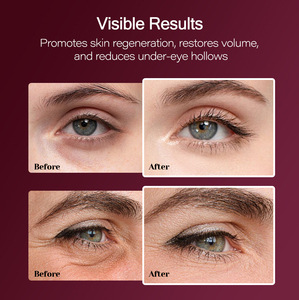 OEM Бальзам-стик с коллагеном и кальцием, корейский, для упругости кожи, увлажнения и успокоения, с кальцием Cemenrete, для лица и глаз - Product Image 4