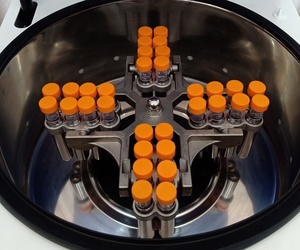 Máy Ly Tâm Tốc Độ Thấp 100Ml Để Bàn - Product Image 4