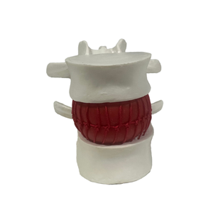 Model kerangka sains medis, untuk demonstrasi herniasi Lumbar bahan PVC untuk pelatihan perawat di sekolah - Product Image 5