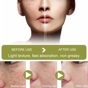 Private Label WestMonth Black Spot Remoção e pele Lightening Creme desaparece manchas escuras e <span class=keywords><strong>melasma</strong></span> para Maquiagem e Uso Beleza - Product Image 5