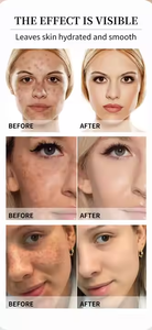 ครีมบำรุงผิวหน้าโคจิกแอซิด 1 กก. แบรนด์ส่วนตัว ลดเลือนจุดด่างดำ สมุนไพรออร์แกนิค ครีมไวท์เทนนิ่งสำหรับผิวหน้าและผิวกาย - Product Image 4