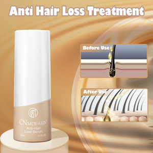 Fabbrica diretta OEM organico Anti-prurito capelli cuoio capelluto olio di zenzero riparazione dei capelli crescita del cuoio capelluto trattamento per la crescita dei capelli - Product Image 2