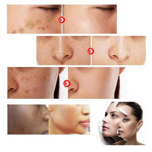 Hete Verkoop Krachtige Anti-Verouderende Huidbleekcapsule Private Label Vitamine C Glutathion - Product Image 4