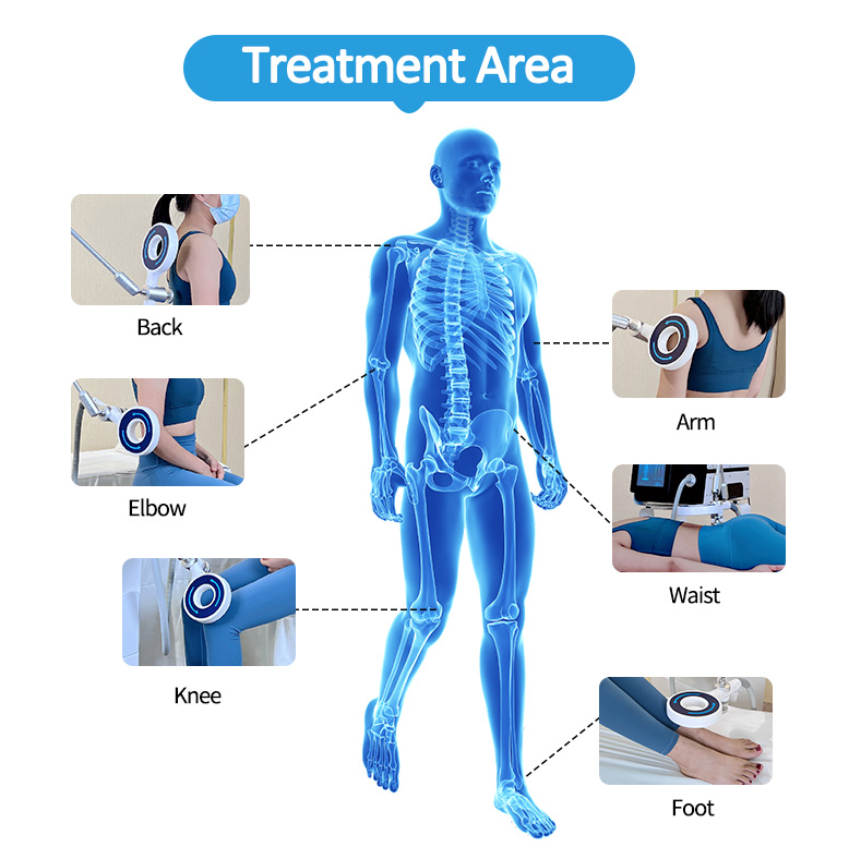 Electro magnetic pulse magneto terapia device magnetotherapy equipment physio frozen shoulder pemf pmst therapy ring machine CE