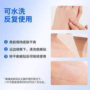 Parches de silicona Chenkang Medical para cicatrices, gel de color piel, apósito reparador para atenuar cicatrices, 1 unidad - Product Image 4