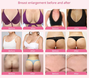 Professional Female Breast Massage Machine Vacuum Cupping Therapy Buttocks Lifting Hip Enlargement - Product Image 6