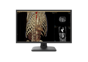 Pantalla de diagnóstico médico gris de color de 4MP de alta calidad - Product Image 4