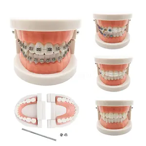 Dental modell Standard Modell für kiefer ortho pä dische Zähne mit Zahnspangen Metall-/Keramik halterungen für die zahnmedizin ische Ausbildung HESPERUS